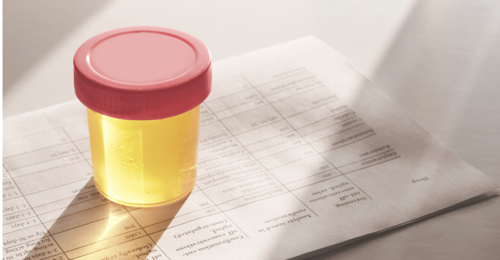 Cup of urine for drug test